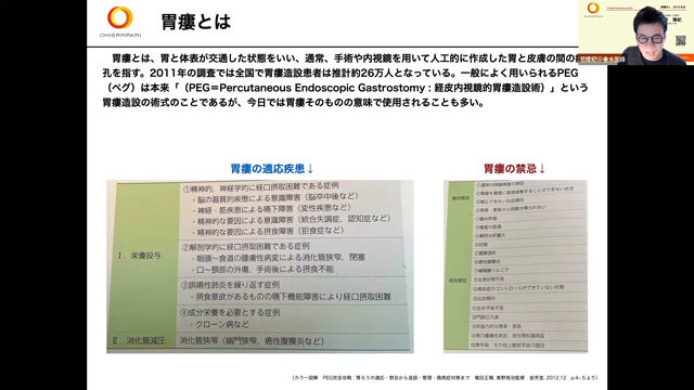 胃瘻
