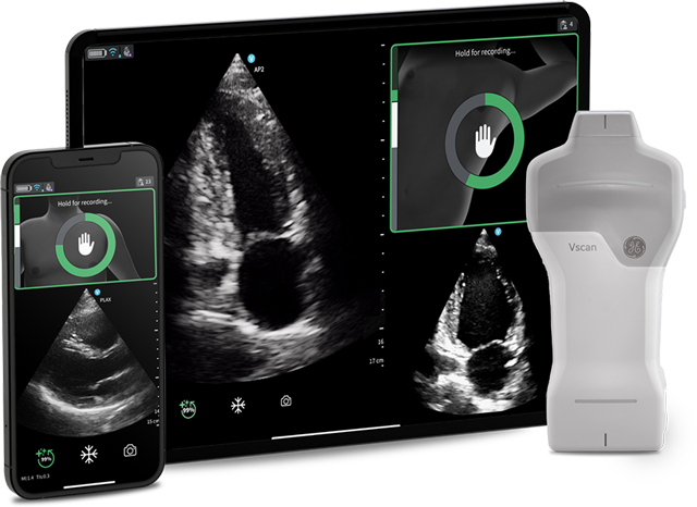 Vscan Air — ポケットサイズの超音波診断装置